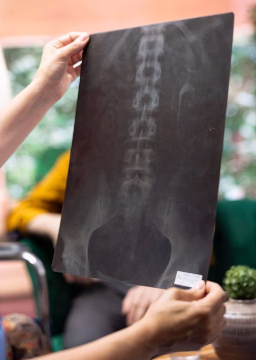 Spine Surgery
