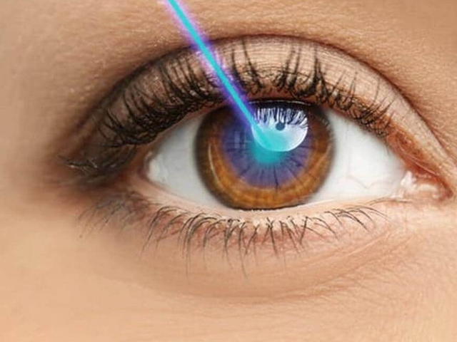 Chirurgie ophtalmologique  Tunisie