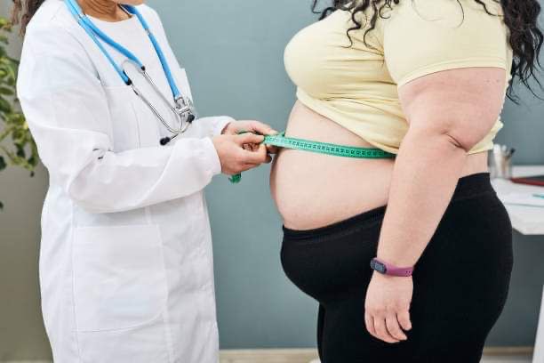 Chirurgie Bariatrique