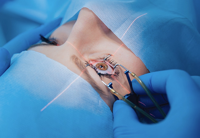 Chirurgie Cataracte Tunisie